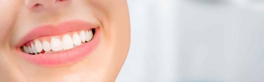 Dental Crown for Front Tooth