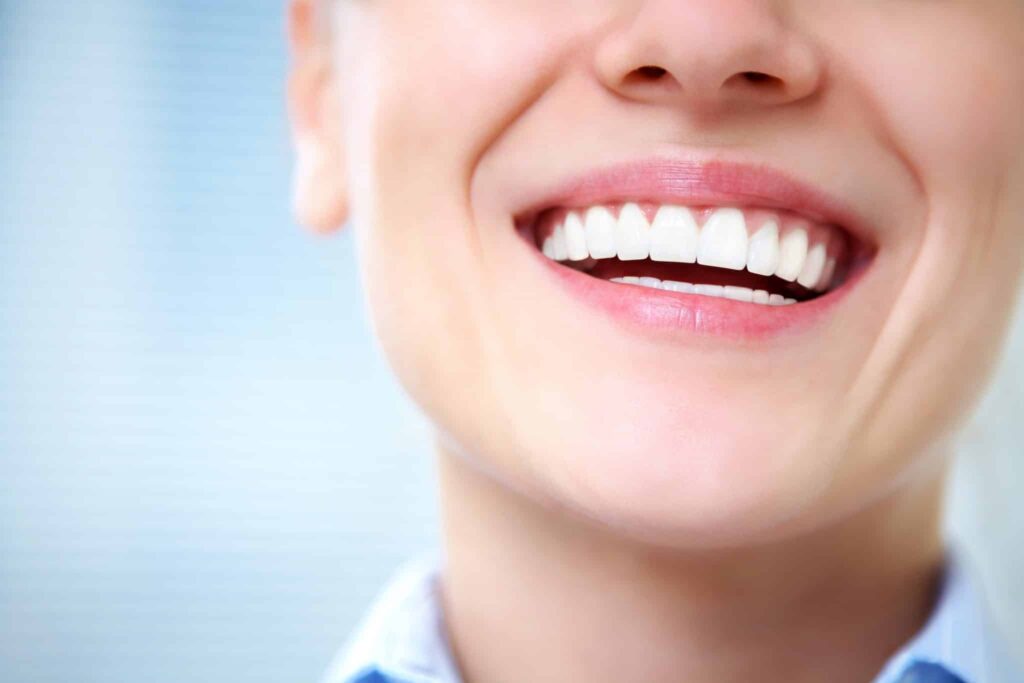 What to Expect During a Gum Lift Surgery