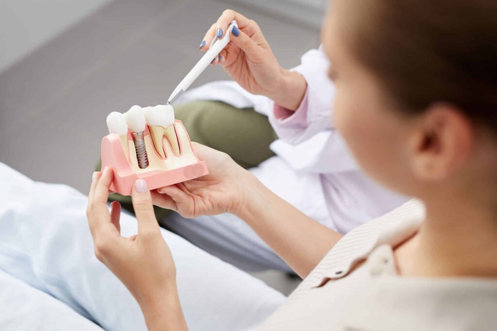 How to Care for Your Dental Implants