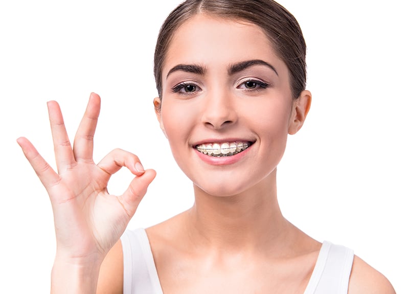 Clear Braces vs. Metal Braces