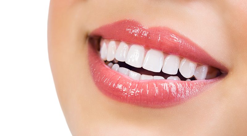 Why Teeth Cleanings Are Important