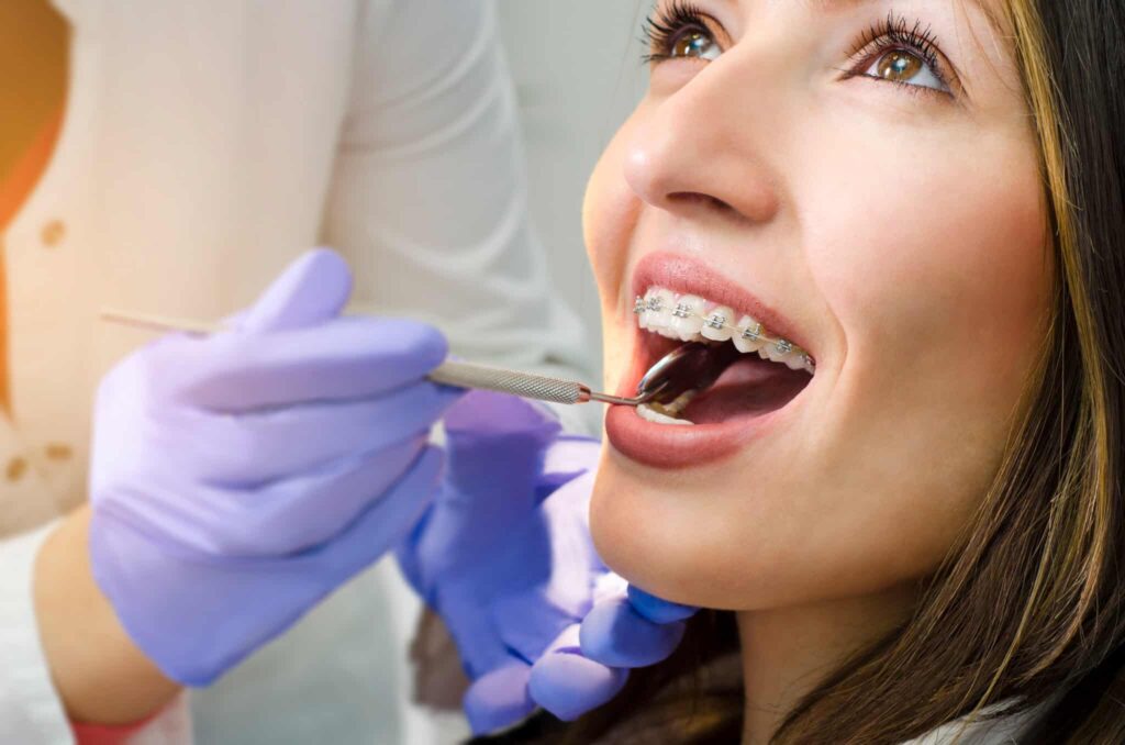 Clear Braces vs. Traditional Braces: Which is Best for You in Murrieta, CA?
