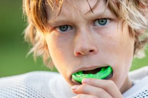 Sports Mouthguards In Murrieta