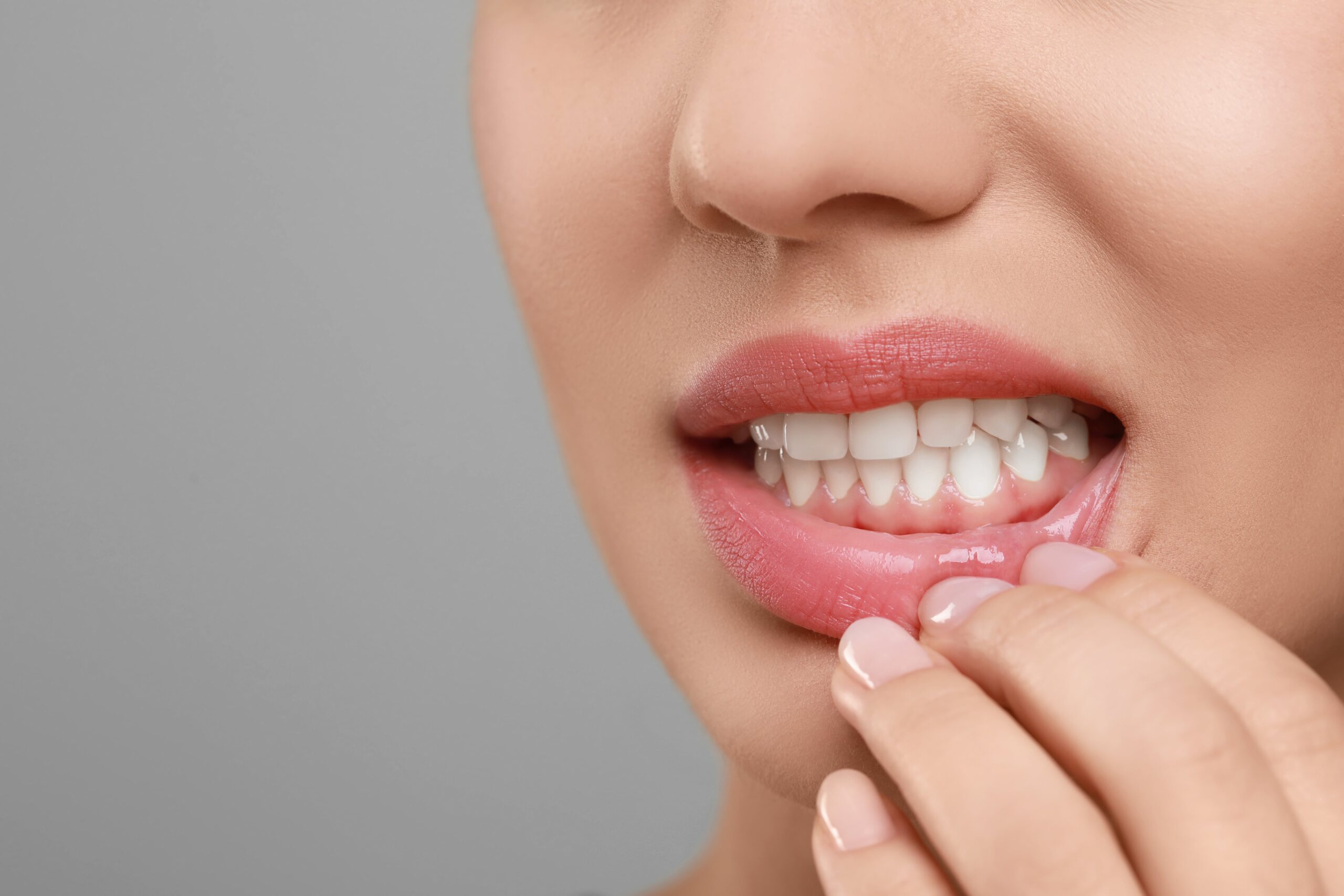 Why Gum Disease Needs Attention Before Your Smile Makeover