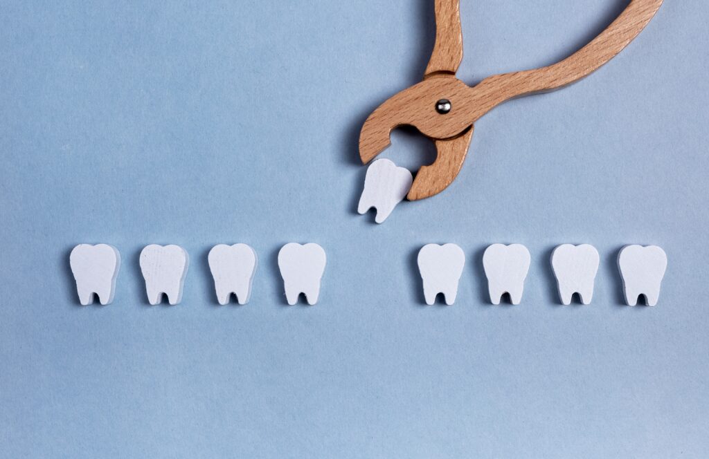 Missing Teeth issue -Dental Bridges in Murrieta