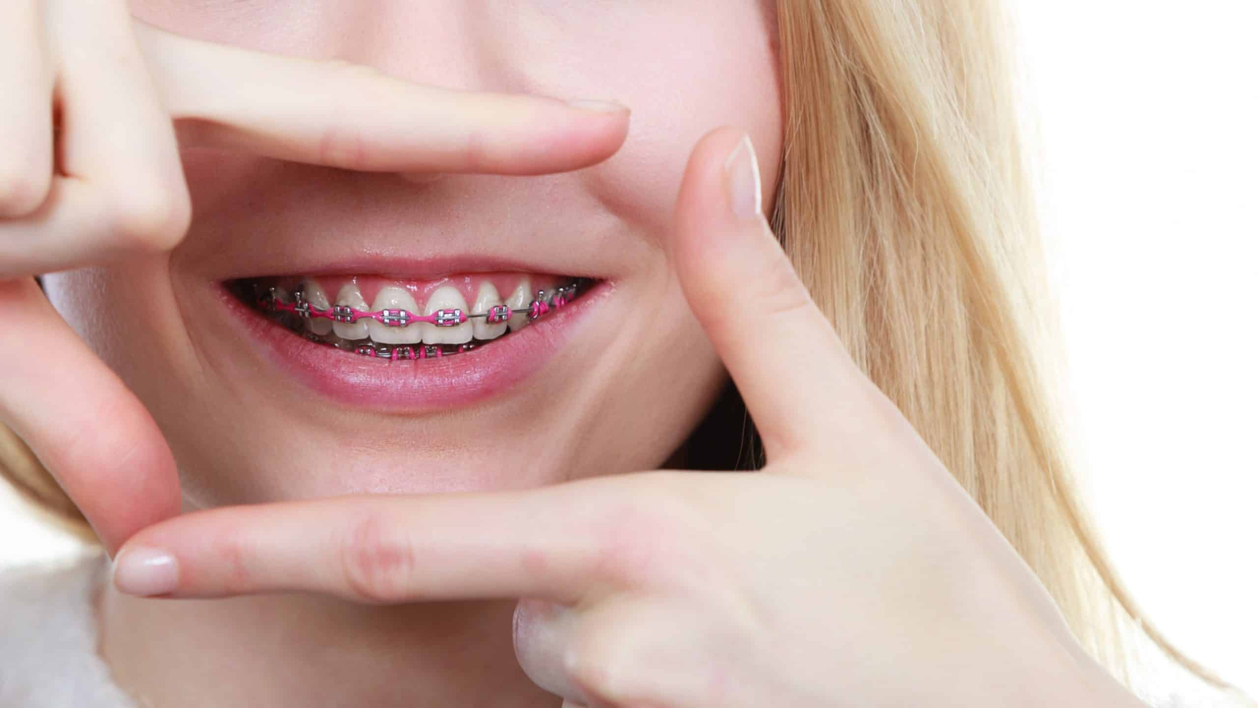 Caring For Your Smile with Orthodontics
